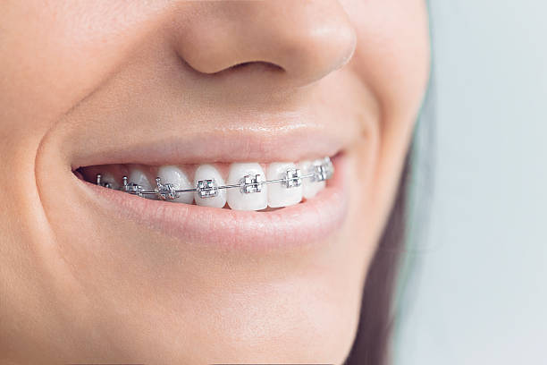 Best Invisalign and Clear Aligners  in Beechwood Trails, OH
